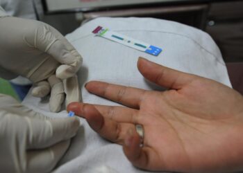 Pacientes con VIH SIDA llegan en fase terminal