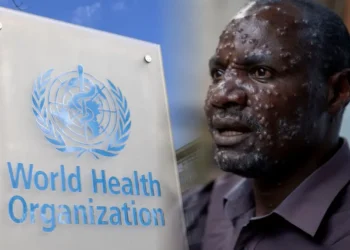 Declarada OMS Nueva Emergencia Mundial por Brote de Viruela del Mono