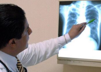 Registra Secretaría de Salud 197 casos de tuberculosis