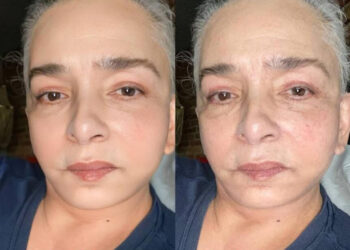 Ana Martin se quita los filtros y se muestra al natural a los 78 años