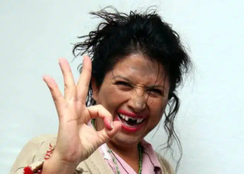 ‘La Chupitos’ padece enfermedad que no tiene cura