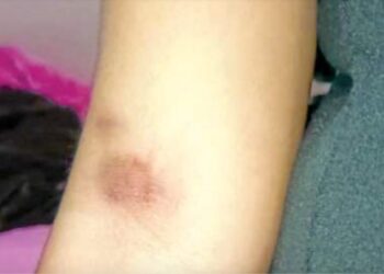 Madre denuncia agresión a su hija en escuela Rosendo Caballero González