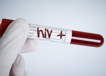 Hay 16 nuevos casos de VIH