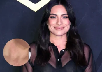 Ana Brenda Contreras revela el problema en la piel que enfrenta tras convertirse en mamá