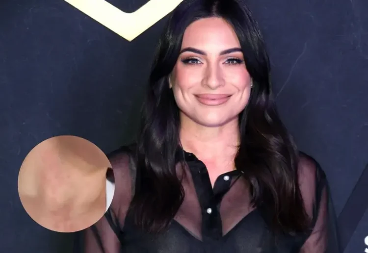 Ana Brenda Contreras revela el problema en la piel que enfrenta tras convertirse en mamá