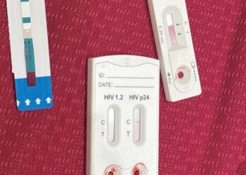 LA CIFRA MÁS ALTA EN 2025  Detectan en octubre 11 casos del VIH