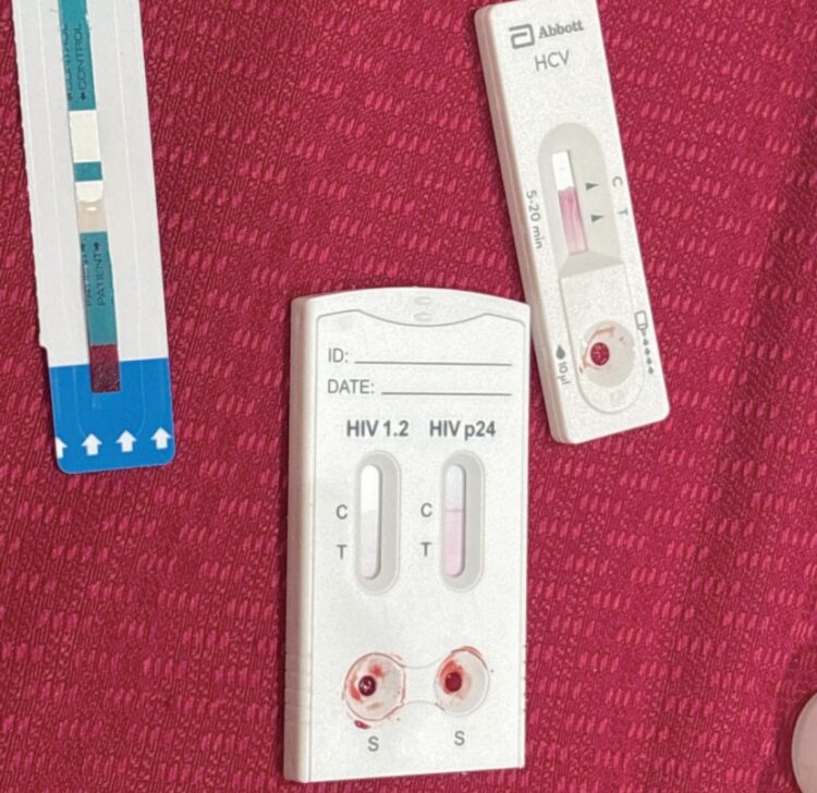 LA CIFRA MÁS ALTA EN 2025  Detectan en octubre 11 casos del VIH