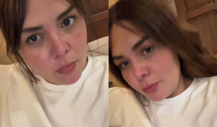 ¿SE QUEMÓ LA CARA? Yuridia pide ayuda en redes sociales