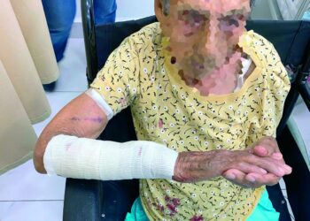 Por ataque de perro abuela resulta con fractura