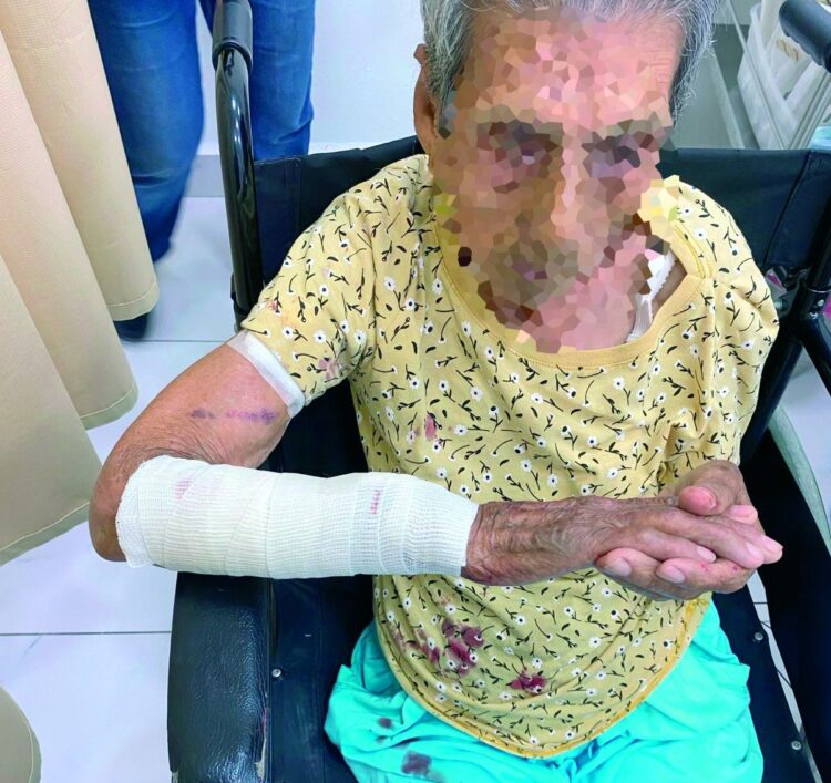 Por ataque de perro abuela resulta con fractura