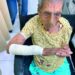 Por ataque de perro abuela resulta con fractura