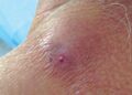 Llaman a vigilar heridas para evitar miasis