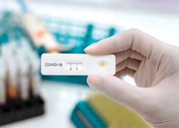 Detectan 4 casos de Covid