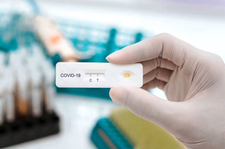 Detectan 4 casos de Covid